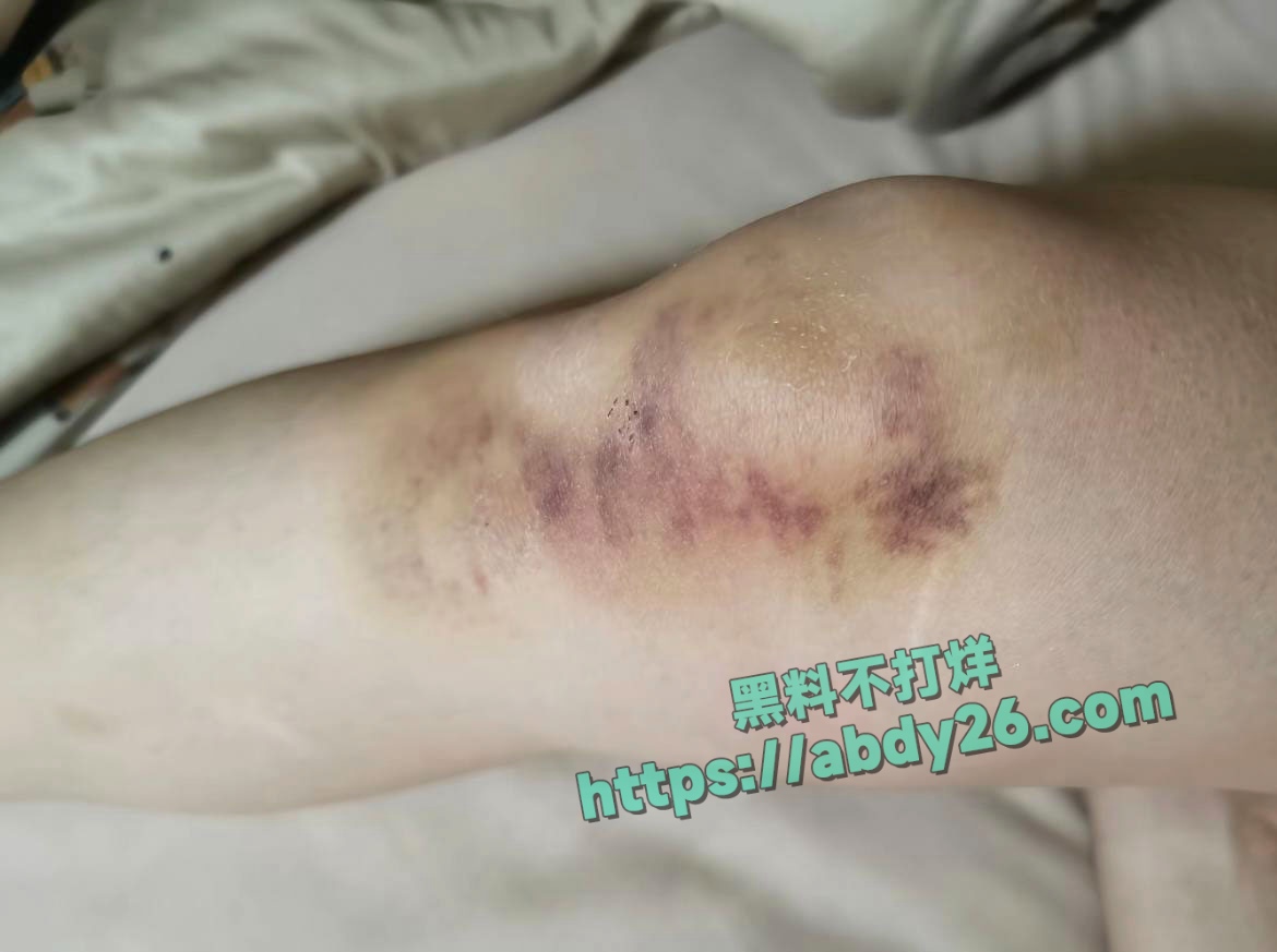 娜姐重生揭露丈夫出轨家暴 41