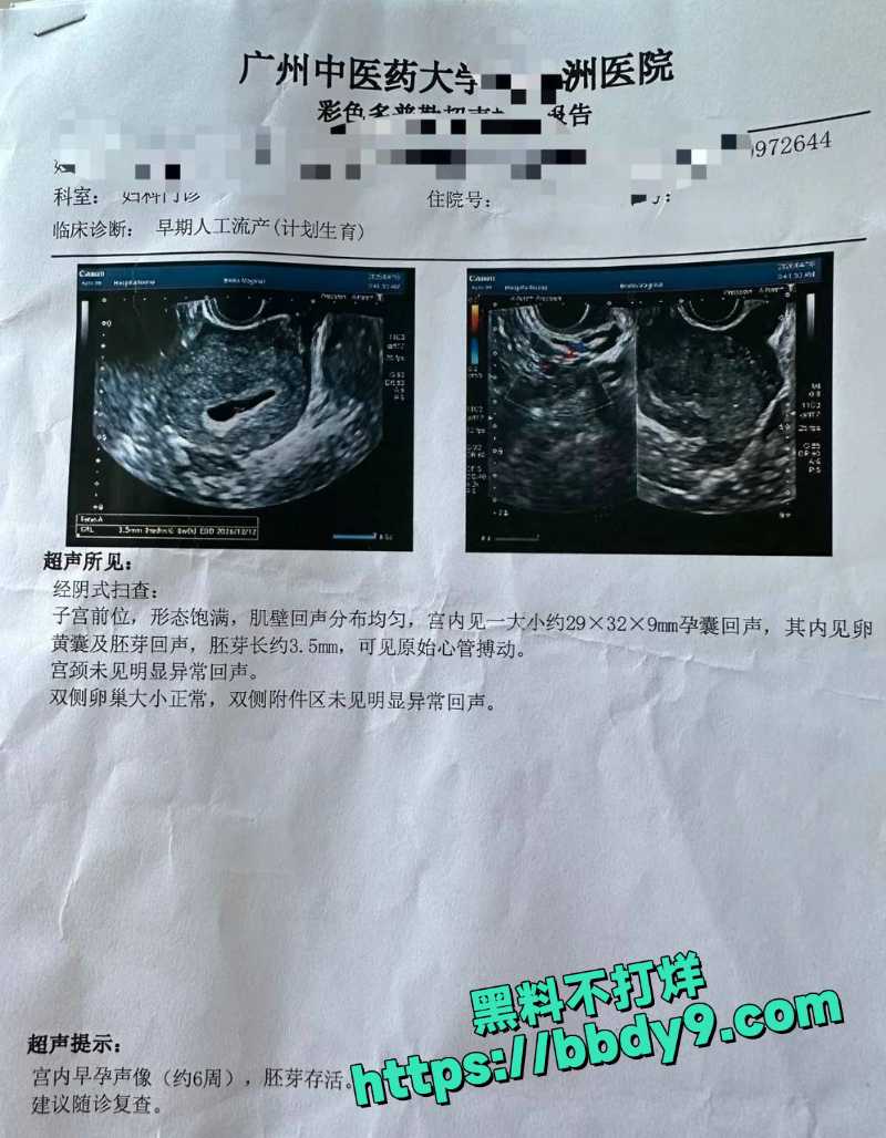 贵阳二小姐 44
