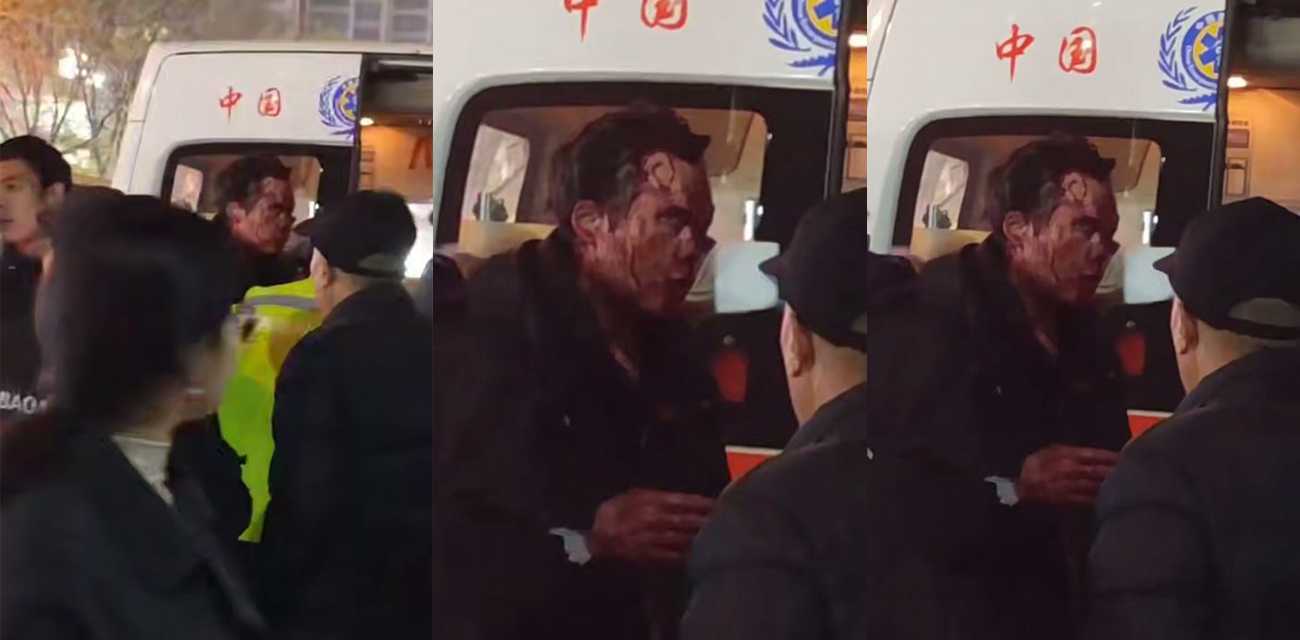 西安华远君城突发无差别砍人事件 一哥们被砍的满脸是血 网传有人脸被砍掉 现场画面曝光