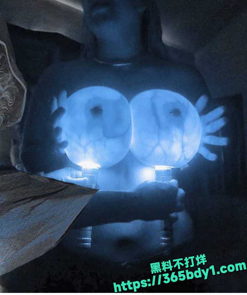 隆胸填充物夜间奇景5