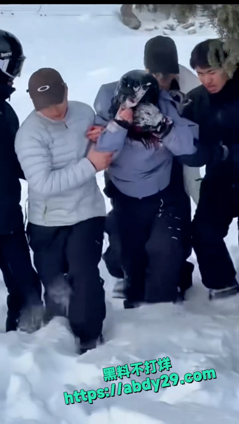 新疆可可托海发生雪豹伤人事件 5