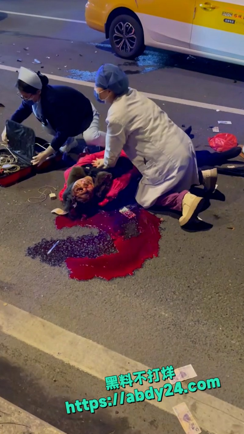 福州闽侯南屿老太太马路被撞 爆浆 2