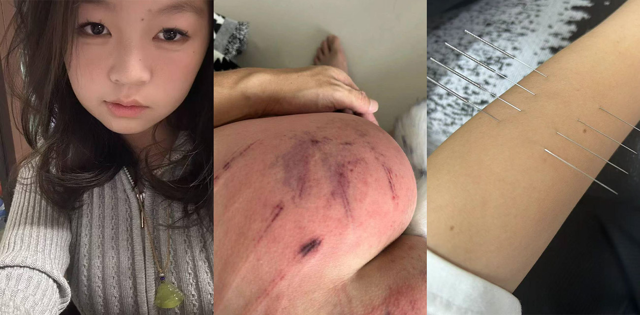 山东滨州博兴三中学生妹 于翰然 SM现场视频 为了追求极致体验屁股都被大叔给打烂流血了
