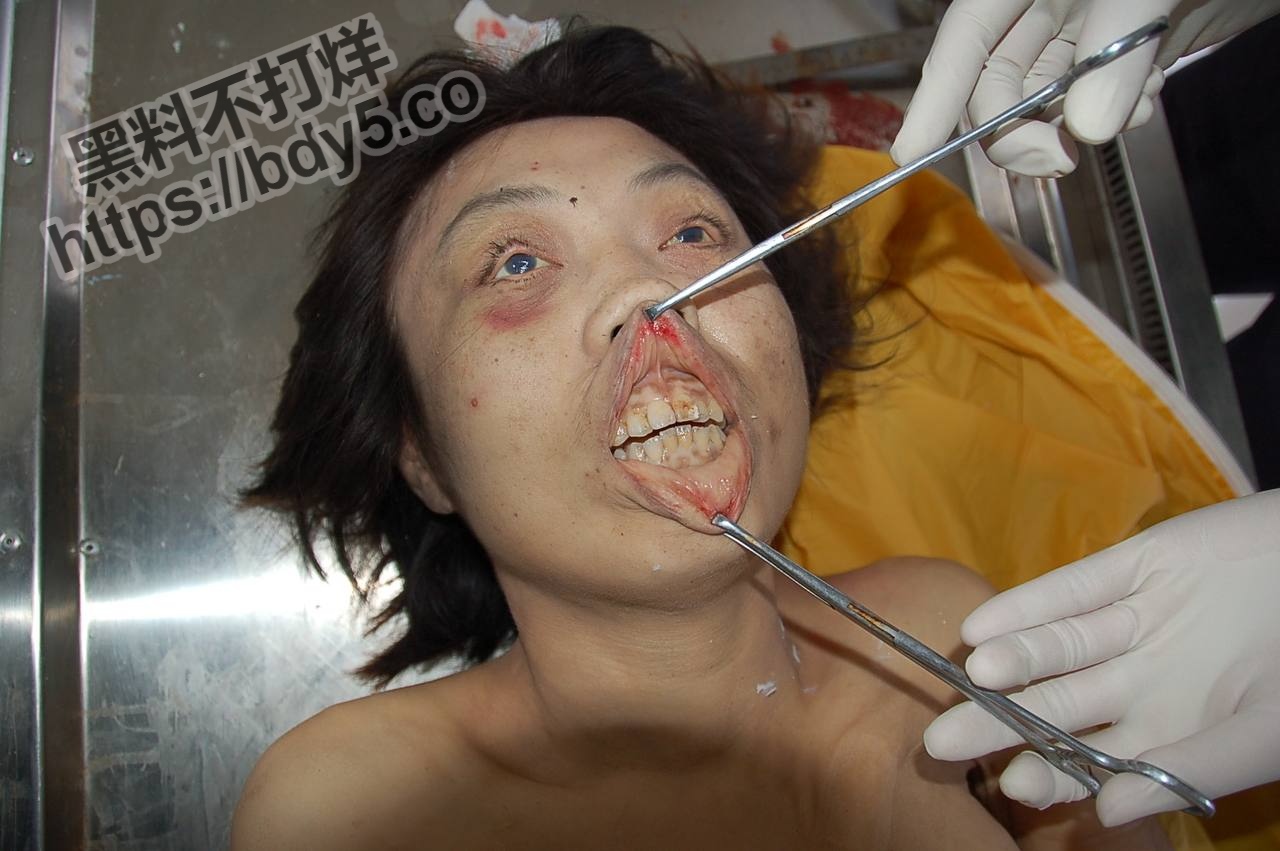 胆小慎入绝密档案之医院太平间.jpg