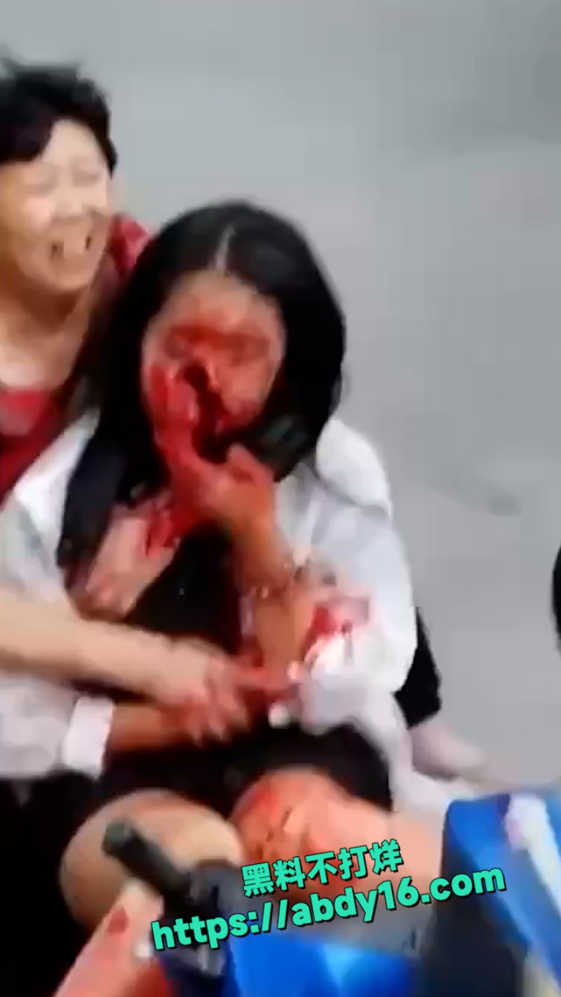 小姐姐骑电动车发生意外 6