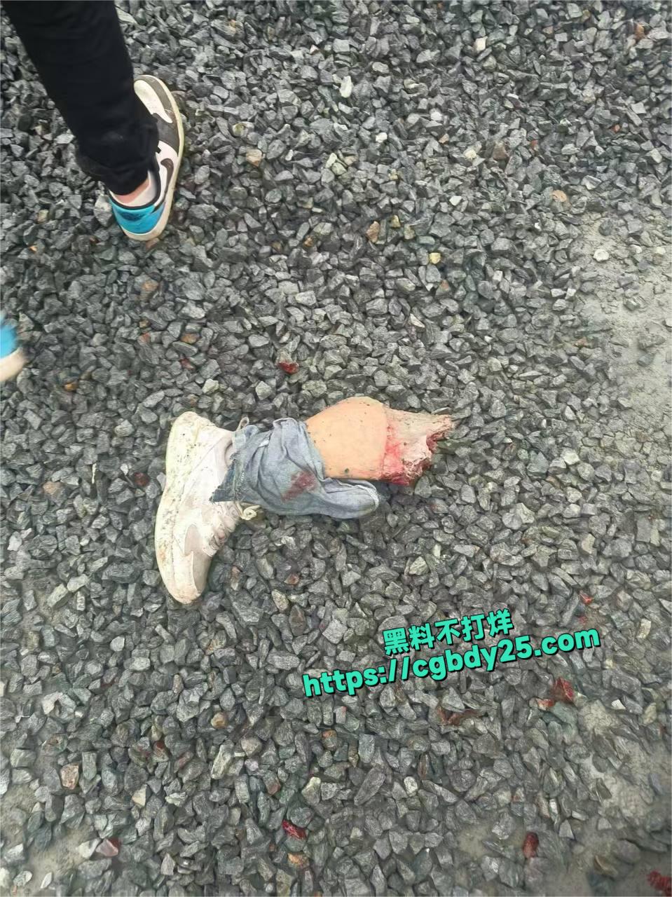 车祸鞋掉了