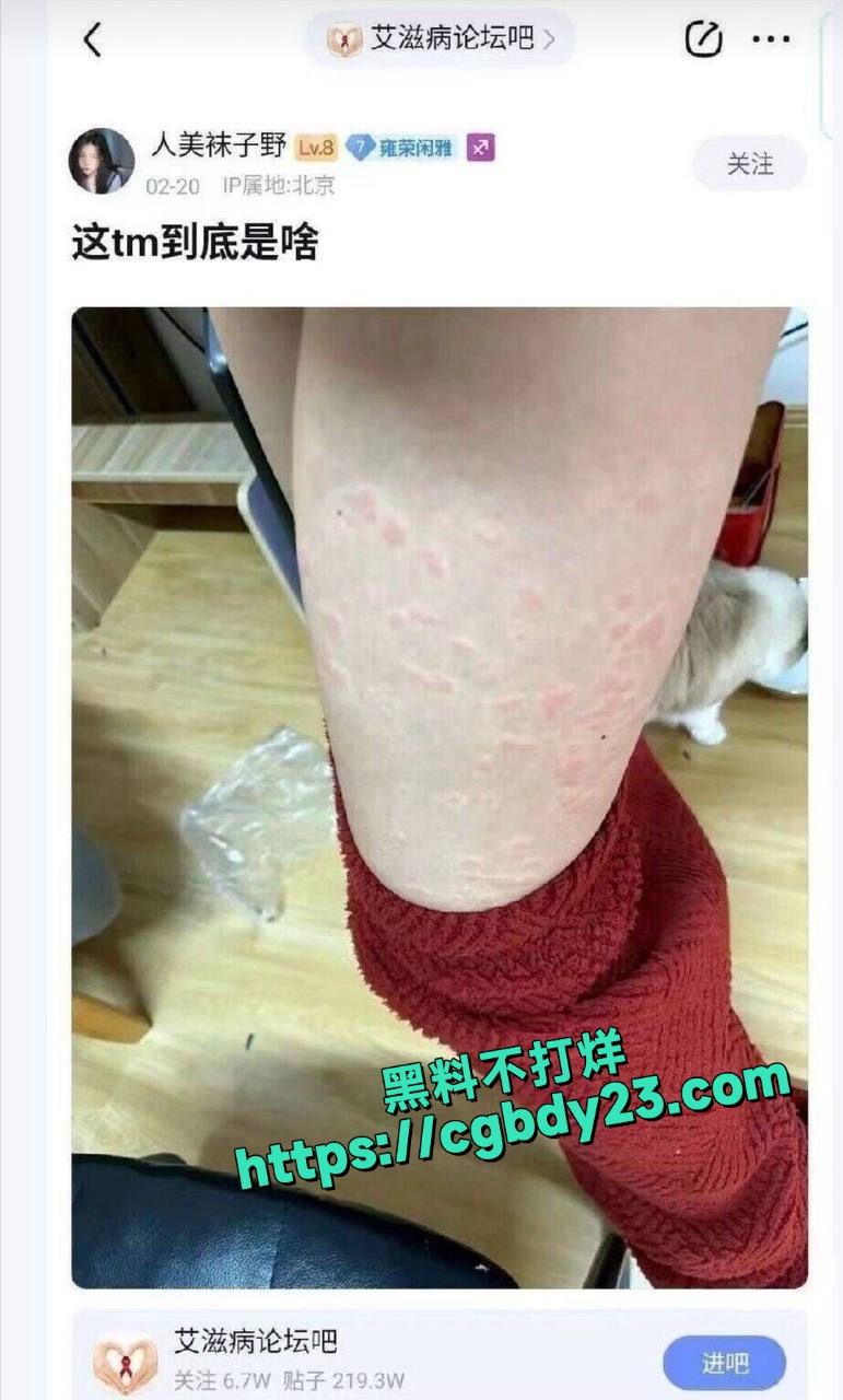艾滋病贴吧5