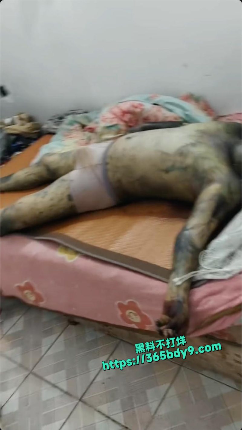 外卖员猝死外卖小哥死在出租屋里发黑发臭5