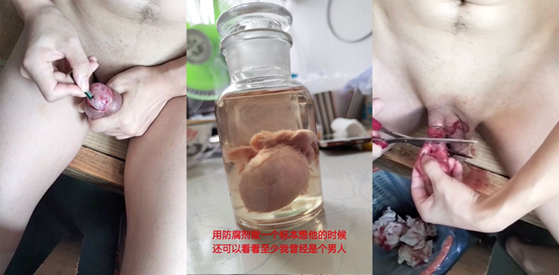警告！慎入！小编看完捂紧裤裆 国产狠人出租屋挥刀自宫 剃须刀片将睾丸阉割切除泡福尔马林