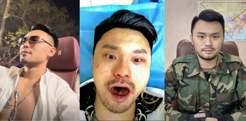 抖音网红 东南亚八面佛 在老挝特区被电诈人员围殴！武艺高超的八面佛终究抵挡不过现实的残酷！