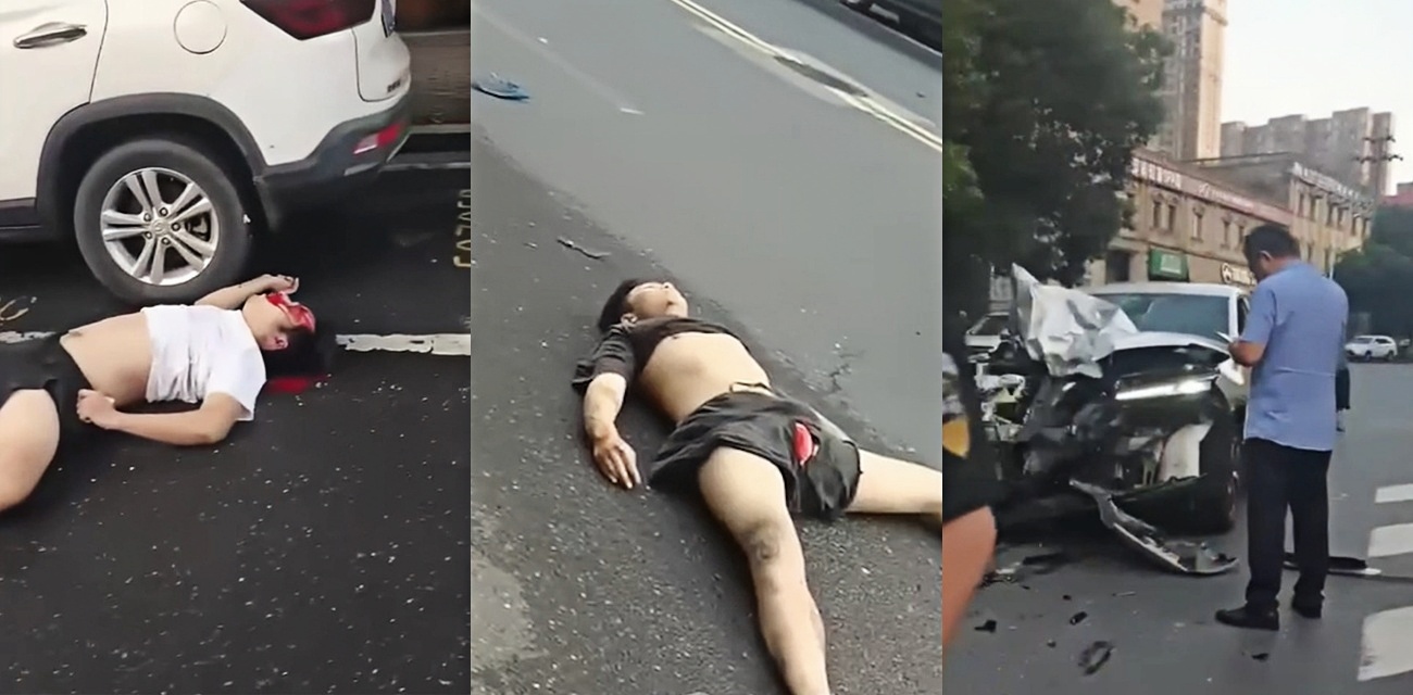 某路段发生严重交通事故看起来是鸡吧都磨烂了 救援部门迅速响应全力展开救治