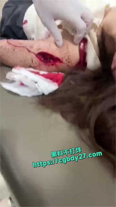 男子持刀砍伤妻子