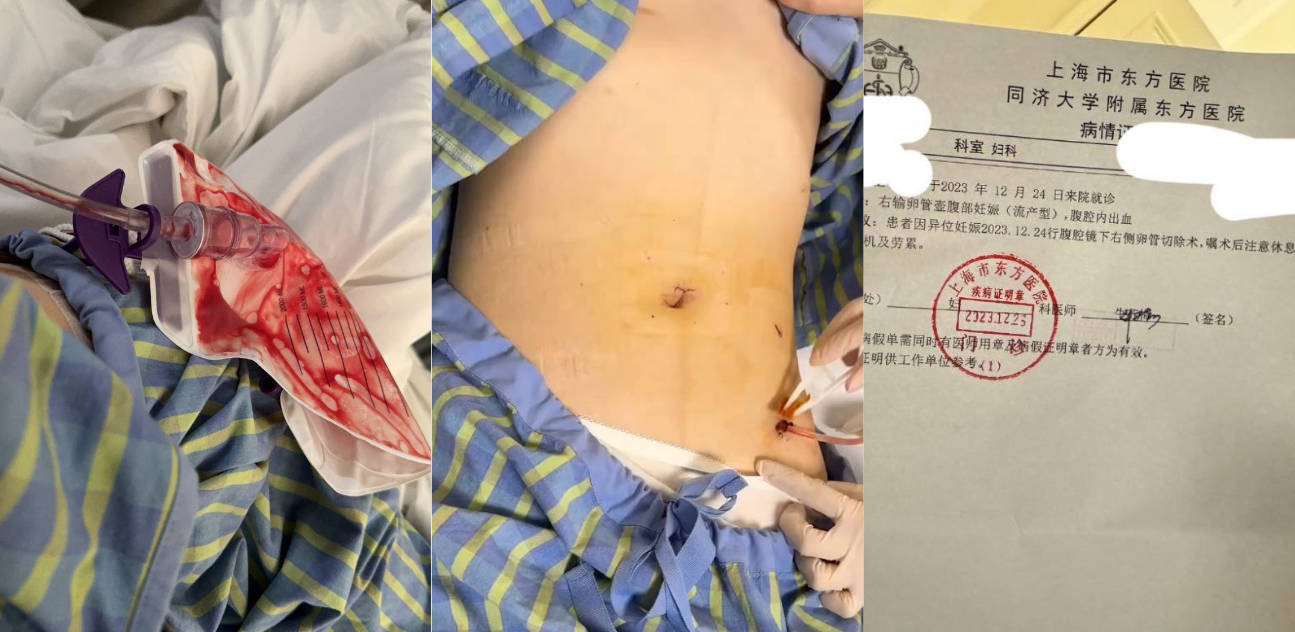 避雷！长沙男模加凡 本名韩飞 江苏南通人 以恋爱为由骗走几十万 导致我宫外孕～