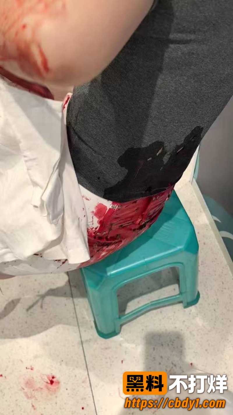 广西玉林十字街砍人15