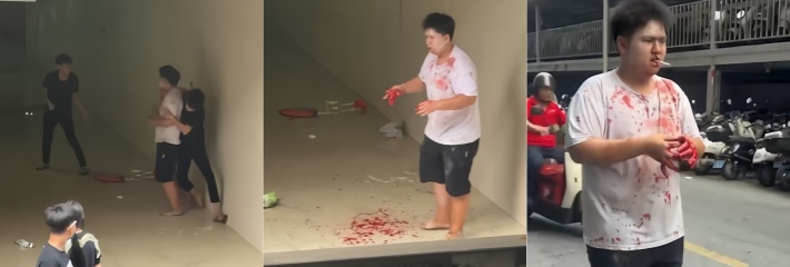 广西南宁大学公园 精神小伙砍断智障男子手指 现场血流一地令人不寒而栗