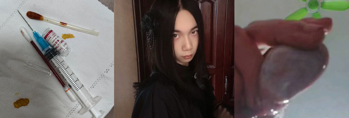伪娘 Mizukishi小单睾 自残割蛋蛋事件曝光 QQ群直播没麻药暴力取睾丸变单蛋