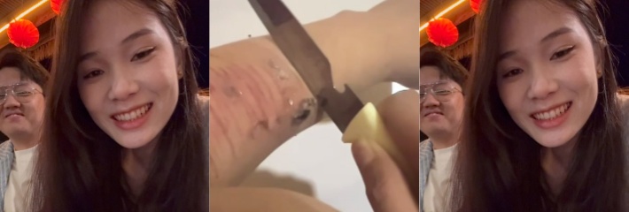 独家爆料 电诈亚太园区女纯爱女战士 为爱自残 一位名叫 香水 的男士不要再躲着了 否则她还会继续自残！