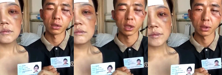 甘肃一对夫妻实名举报被银行职员殴打 目前涉事职员已被停职行拘！