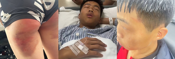 郑州塔沟武校老师暴力教学 用棍棒虐待加飞踢学生 少年浑身是伤医院病床照曝光