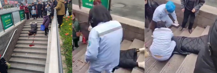 四川自贡地下通道楼梯一女子看手机不慎跌倒 头部大量出血 估计快不行了