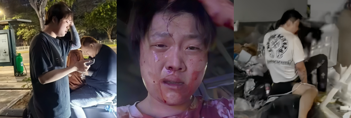 深圳抖音小网红 赵俊逸 遭遇被打事件 现场混乱血腥暴力 疑似为博流量还是另有隐情？