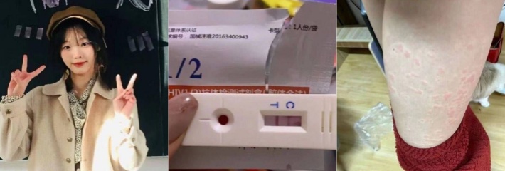 艾滋病贴吧新增成员 卖原味内裤定制视频的小姐姐中招 贴吧发帖寻求帮助!