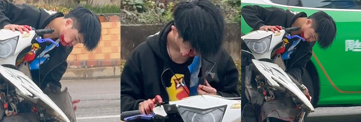 贵州黔东鬼火少年飙车失误差点吃席 脸都摔烂了还有心情照顾看车 真是爱车如命！