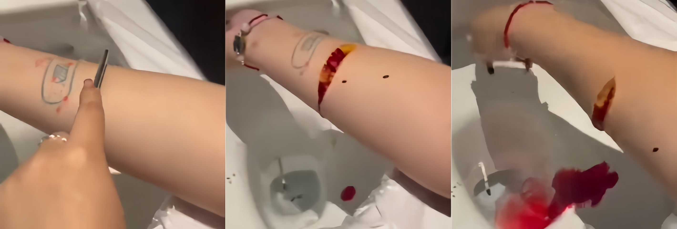 最近网上疯传 马桶女孩 割腕视频疯传 画面血肉模糊令人不寒而栗 希望我们的瓜友永远不要自残!