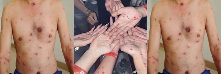 江苏溧阳惊现毒王 李思妤 在生日时约三个男同学玩群P 女孩主动送逼却成三男生染梅毒的噩梦！