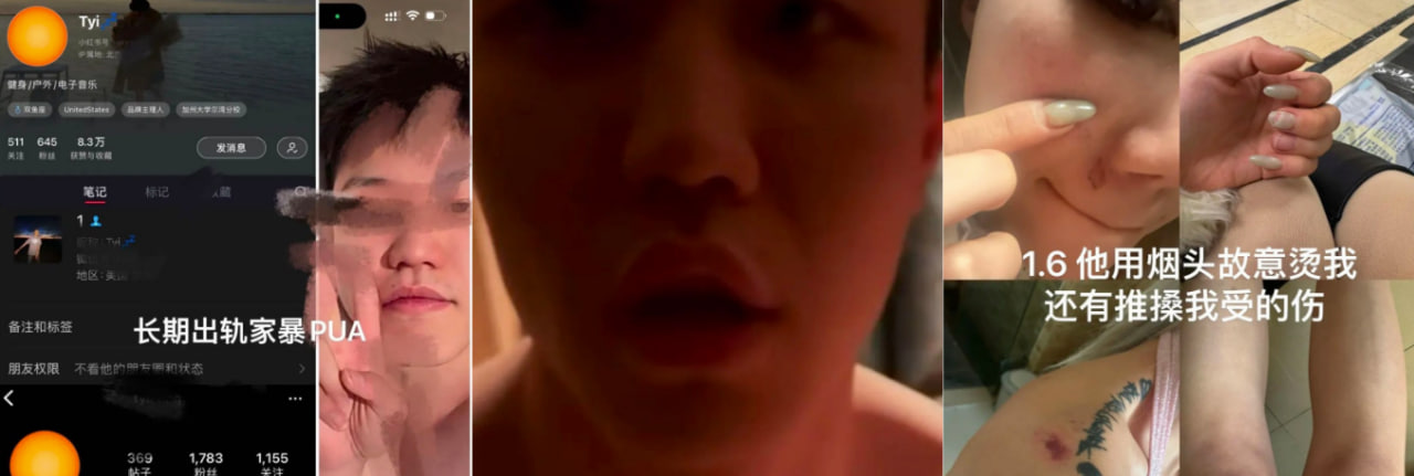 北京PH酒吧的瓜，UCI辽宁北京渣男张天一 强奸 施暴10+次重伤 出轨多次 PUA 不负责玩失踪
