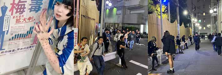 炸裂思维看日本！据统计近年来日本感染性病梅毒数量激增 而日本妹子却把梅毒当时尚