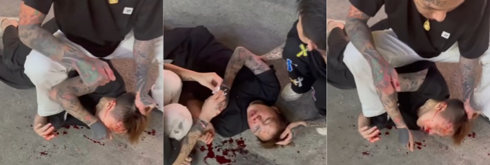 精神小伙吃药吃嗨持刀砍人 肋骨断裂满脸是血 现场惨不忍睹