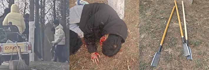 山东临沂沂水县上演现实版古惑仔 数名精神小伙持刀砍人！陈小春都入党了 你们还火拼？