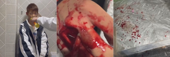 社会混子残忍虐待暴打小伙极其残忍！手背戳开一个大洞连骨头都露出来了真恐怖！
