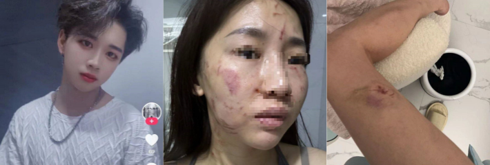 广东揭东 高浩南 家暴妻子被曝光！不是所有的浩南都是好人~家暴男就应该被就地正法！