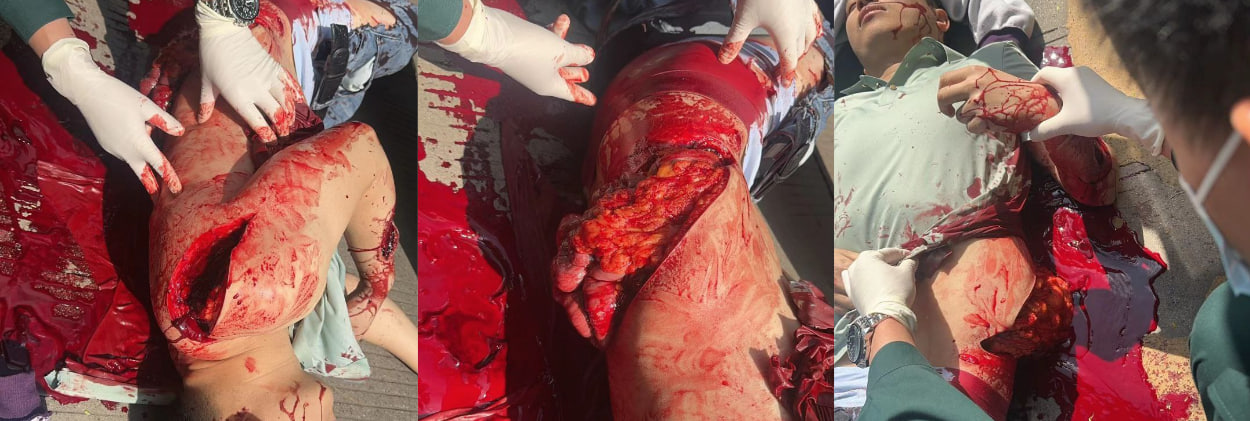 血腥程度堪比鬼片！云南开远一男子因情人节玩别人老婆被发现后爆砍！