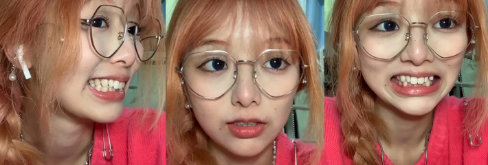 甜美网红 香菇终结者 口腔自查大攻略 甜美笑容下隐藏的健康大揭秘