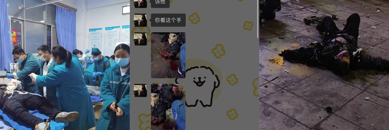 多名年轻人疑似在引燃自制的炮竹时发生意外被炸伤！现场一片狼藉看似没救了！