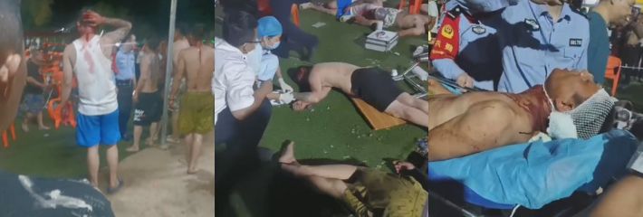 海南海口市大致坡几名内地小伙醉酒摸他人老婆屁股遭受围殴 据说几名小伙还死了好几个！