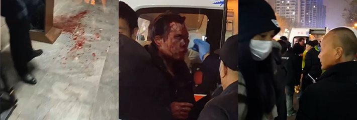 西安华远君城五期 一男子无差别砍人事件 现场视频曝光！