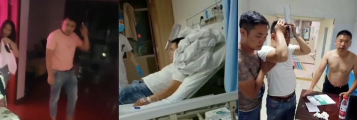 这才是真的命大 色字头上一把刀 乱搞破鞋遭开瓢 菜刀直接砍进奸夫脑袋里！