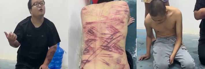 缅北猪仔的悲惨人生volg 业绩未达标被残忍暴打的遍体鳞伤 沦为案板上的猪肉 任人宰割！