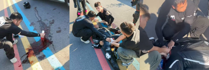 小咖无比 骑摩托车祸惨重 鲜血染红路面 触目惊心 私密部位因剧烈撞击破裂 血流不止 ！