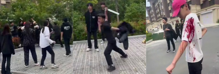 精神小伙街头斗殴 两男子被一群人围殴 红毛白衣小伙被刀砍伤手臂 血流不止