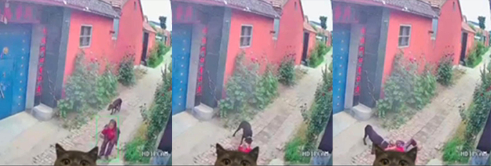 山东荷泽 八旬老太太被一条黑狗撕咬 鼻子被咬掉 双眼瞎了!