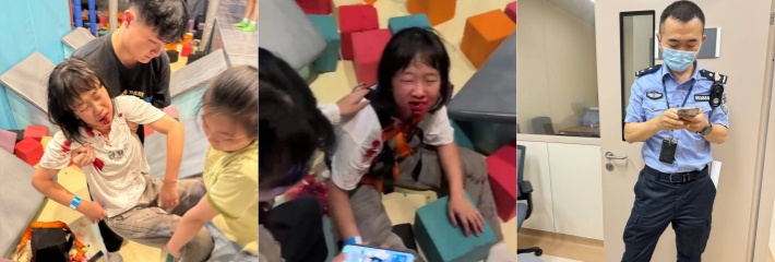 奈尔宝不做安全措施 导致一名女童从12米高空摔下来 血腥现场!