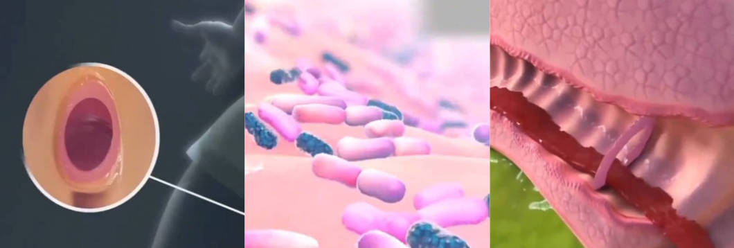 黑料涨知识课堂 给大家科普讲解处女膜的形成与作用 好奇瓜友看过来！