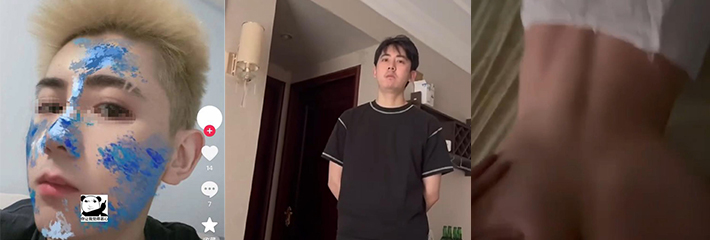 柳州炮王无套男 莫畯淞 脚踏多条船导致女友染病 姐妹们擦亮眼睛避雷！