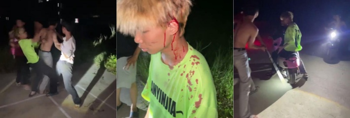 钢管是用来跳舞的不是来打架的 广西南宁精神小伙被打得头破血流！