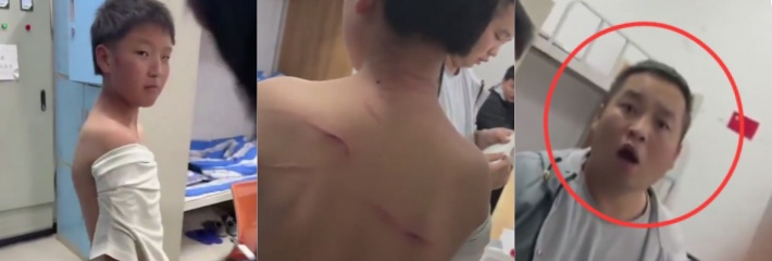 陕西电子信息职业技术学校一学生被霸凌殴打 同学反馈报警却被老师严厉制止！